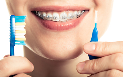 Brushing with braces